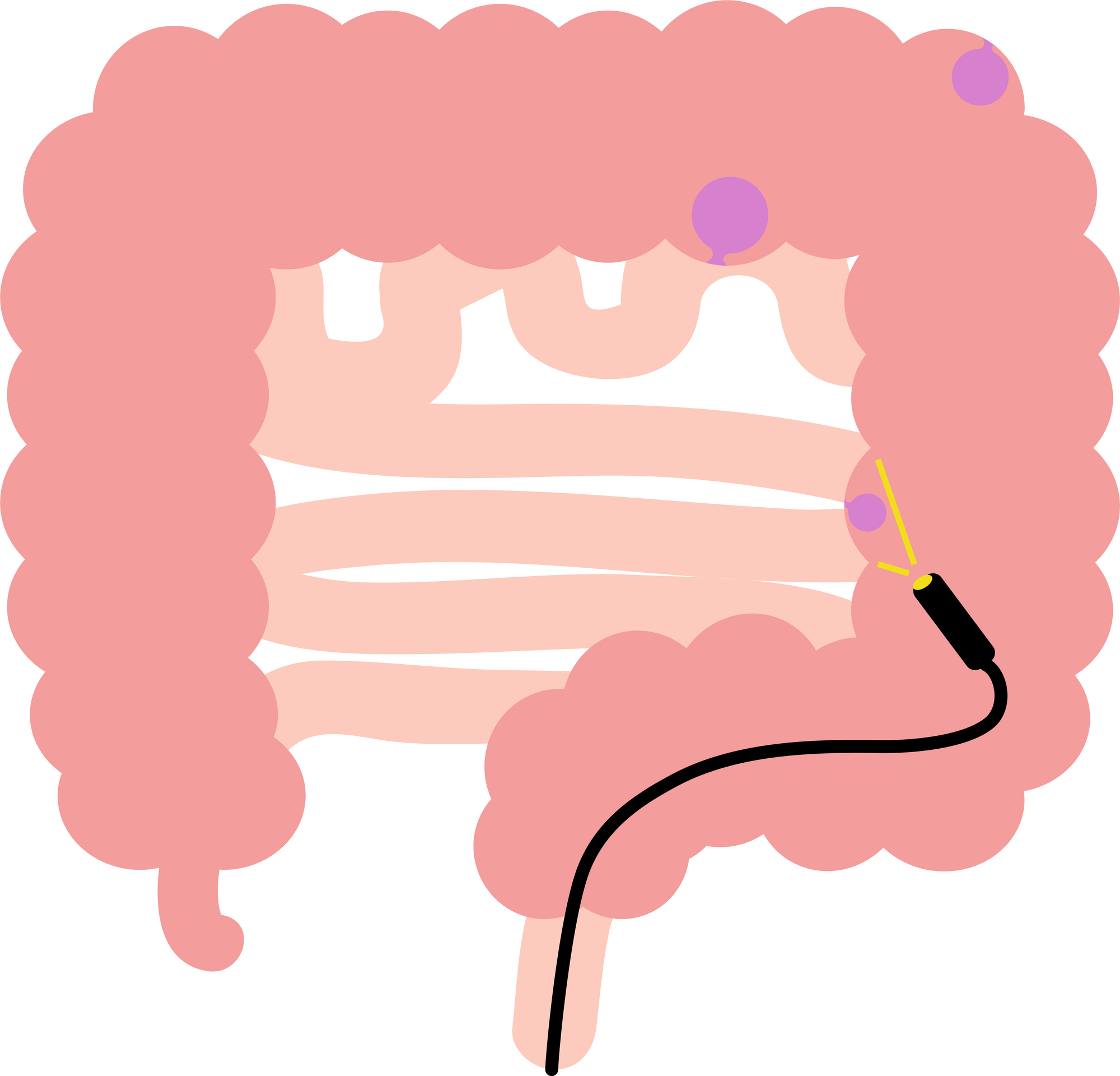 大腸カメラ（下部内視鏡検査）が必要な方